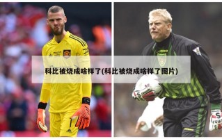 科比被烧成啥样了(科比被烧成啥样了图片)